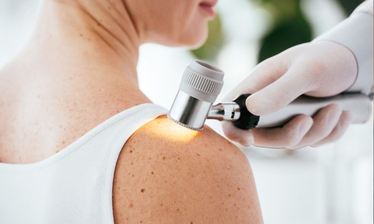 ¿Cuáles son las especialidades en dermatología?